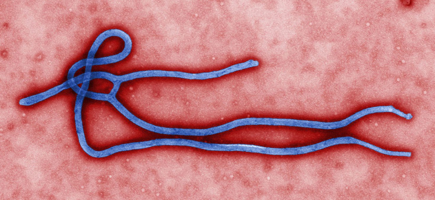 Ébola: le Japon peut fournir un médicament
