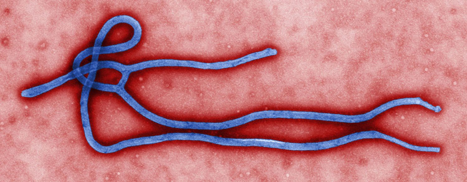 Ébola: le Japon peut fournir un médicament
